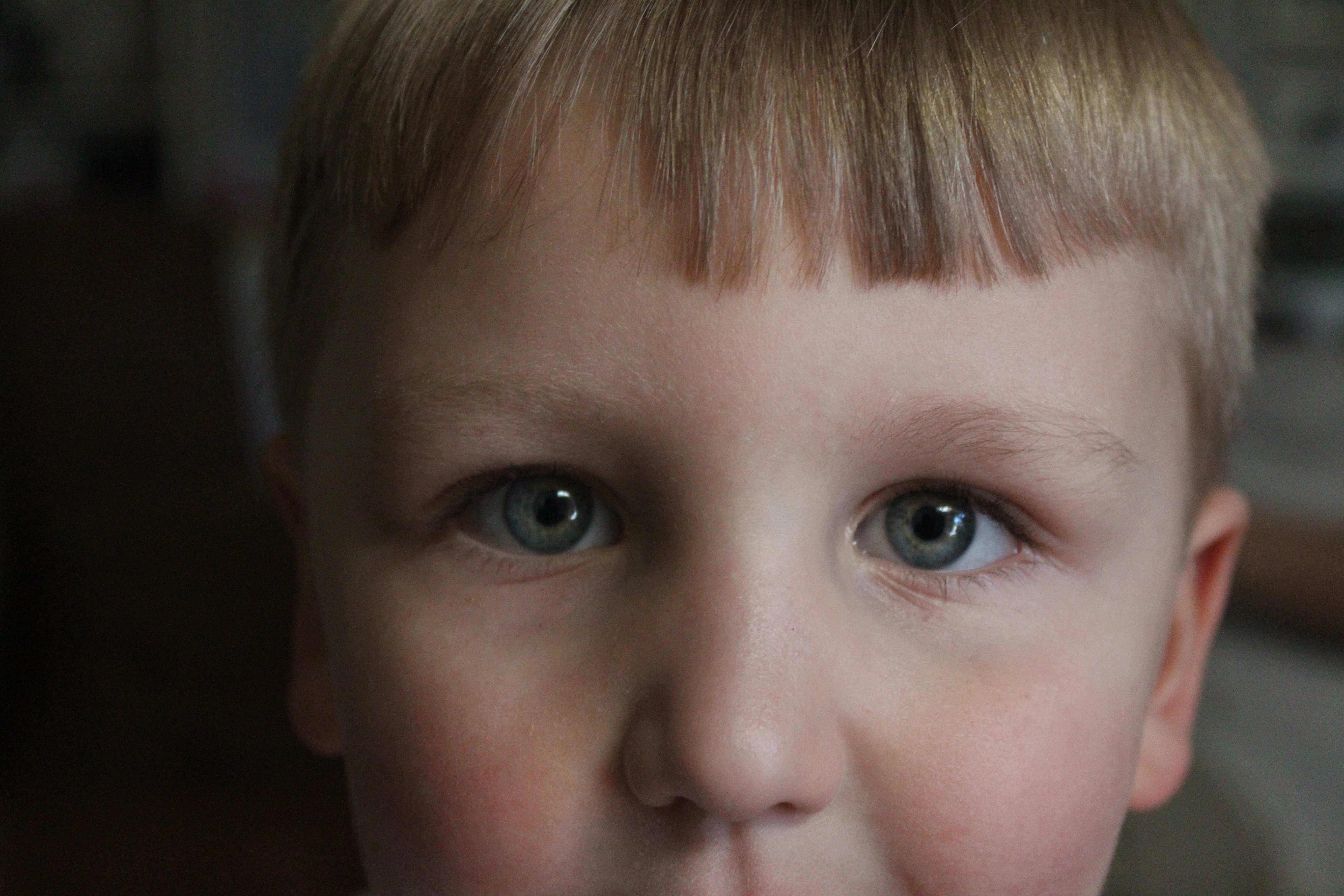 Curs Diagnòstic i tractament de l’estrabisme infantil i adquirit