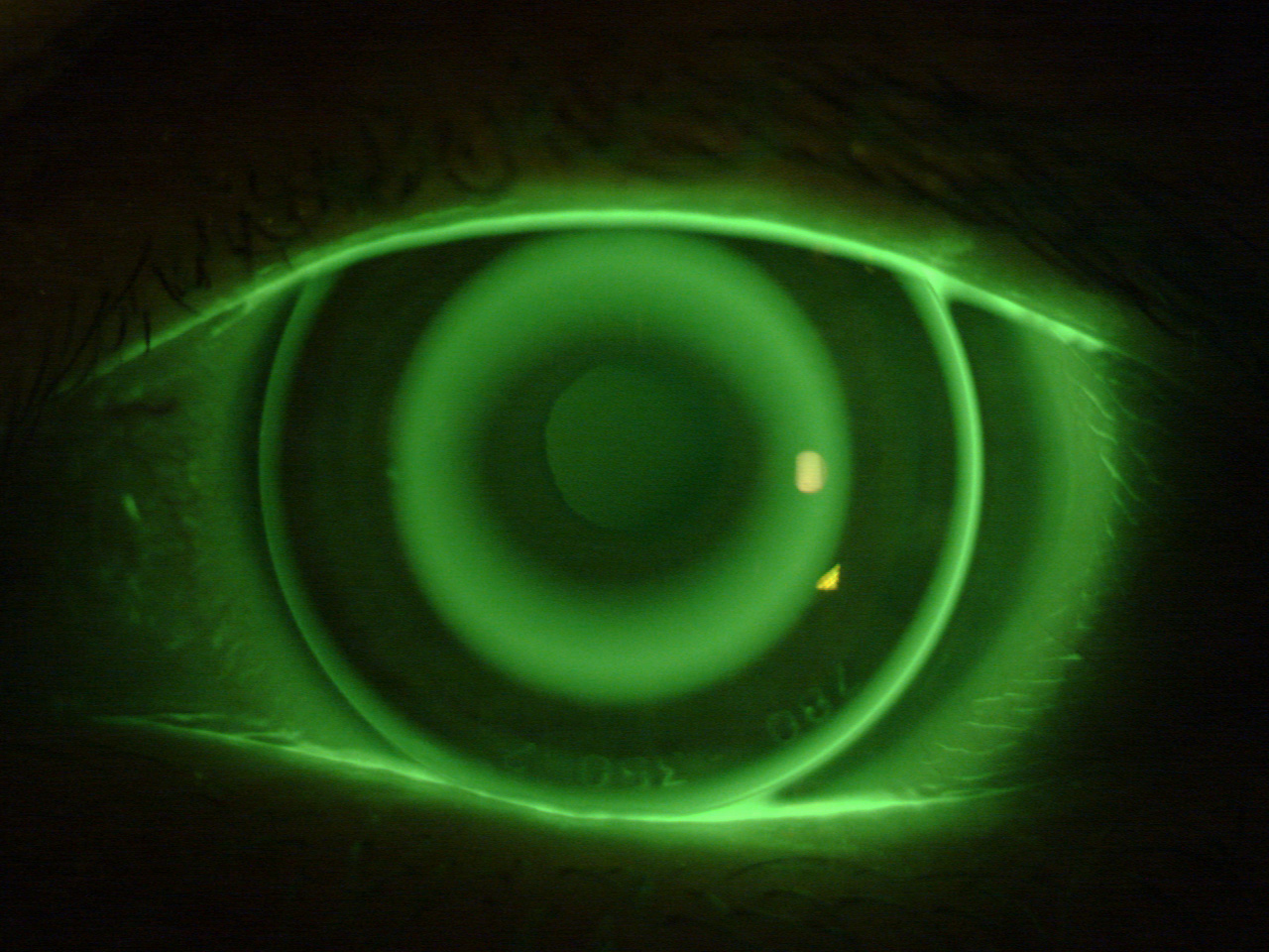 Curs d’Iniciació a l’ortoqueratologia