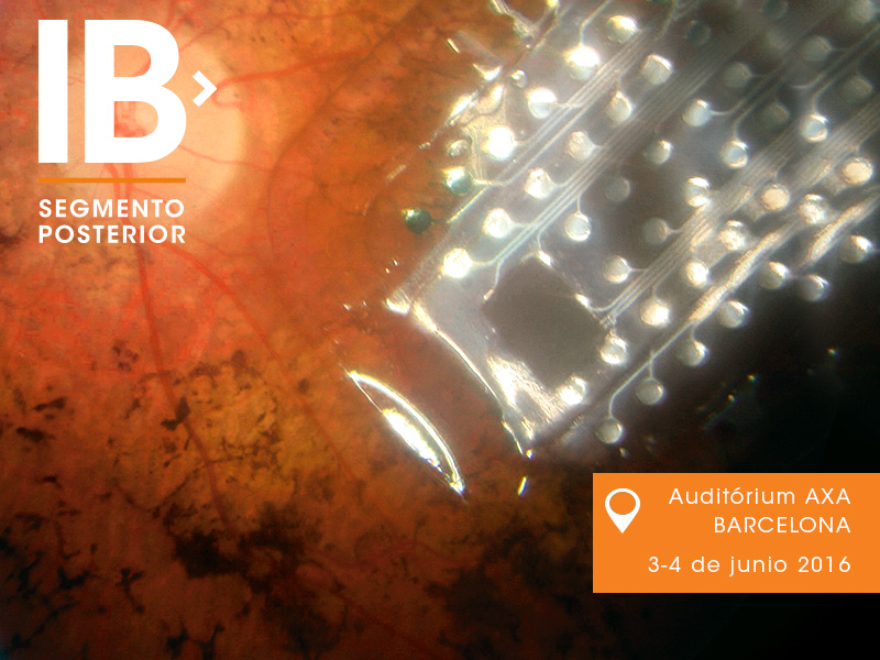 Curs sobre Màcula per l'Institut Barraquer